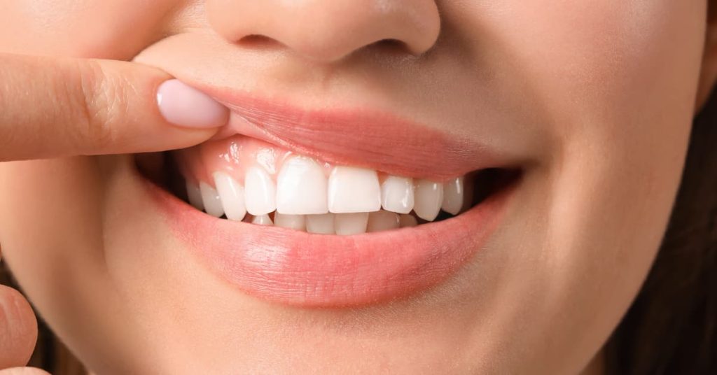 what do healthy gums look like