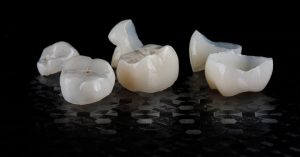 How much do dental crowns cost in Canada in 2026?