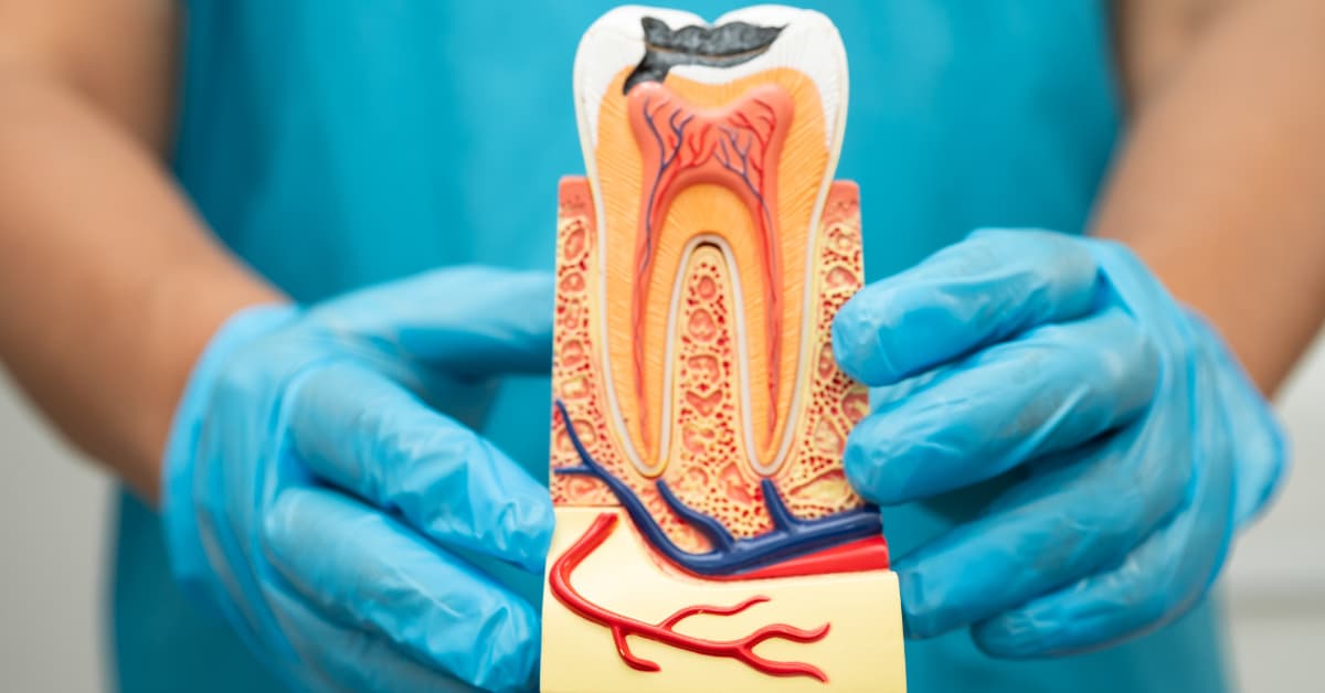7 root canal symptoms