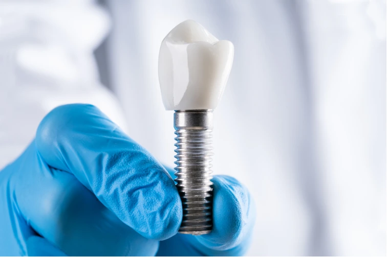 Close-up of a dental implant featuring a titanium screw and white artificial tooth crown held by a dental professional wearing blue gloves, illustrating a tooth replacement option.